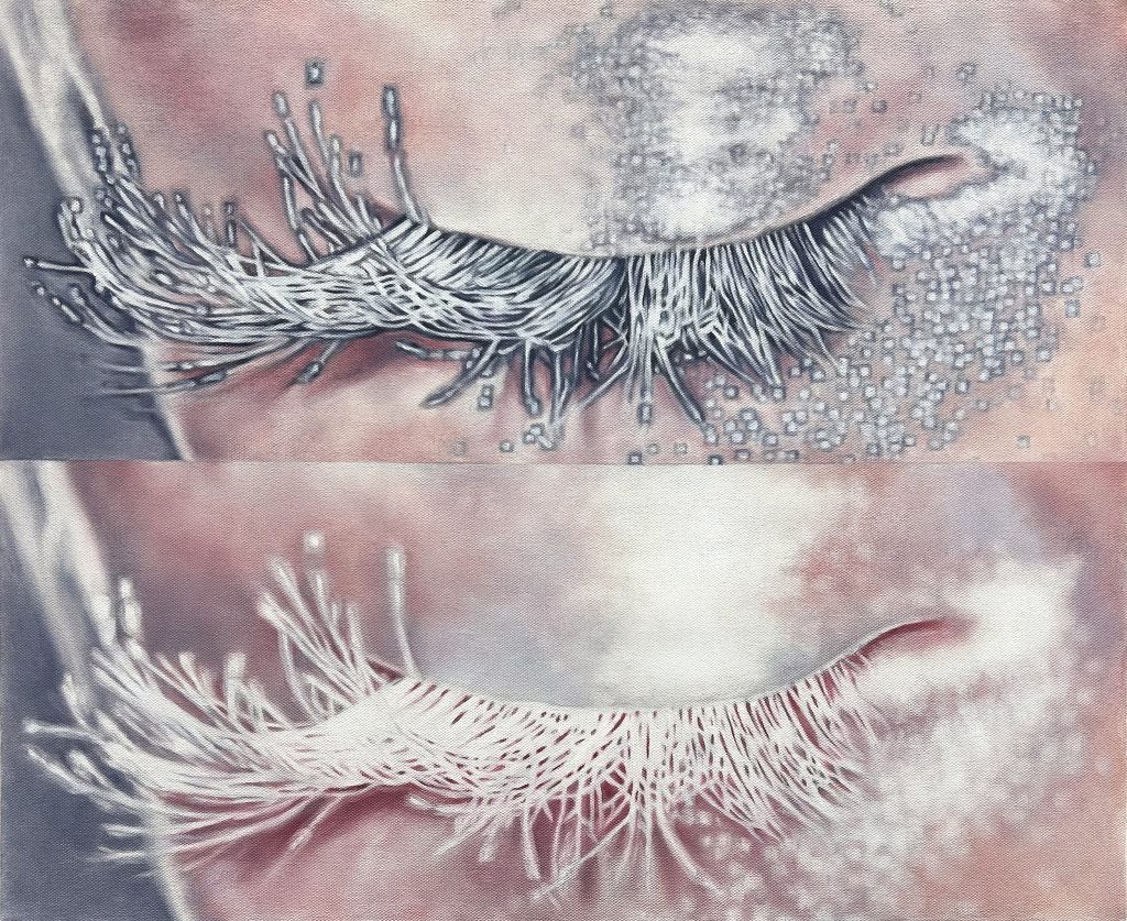 Mitosis